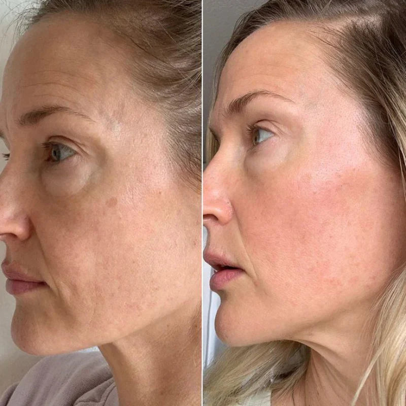 HydroBeauty Boost | Duo Sheet Mask Set | 1+1 FREE