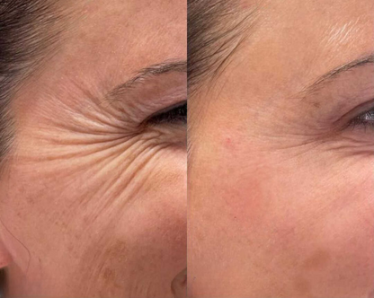 HydroBeauty Boost | Duo Sheet Mask Set | 1+1 FREE